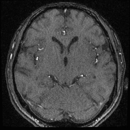 Click on the Serie image to view the images of VILLANUEVA, WILLIAM A.